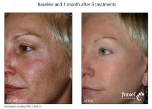 treat sun damage Texas