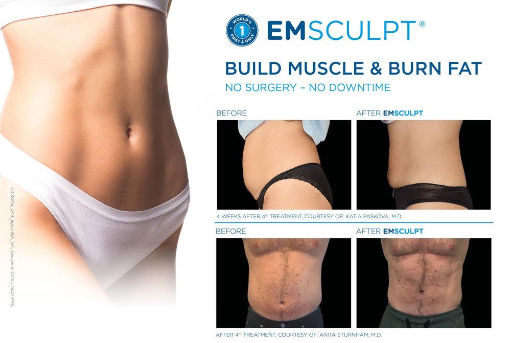 Opt for Emsculpt Body Contouring Treatment & Get Best Results - Fountain  Medial SPA