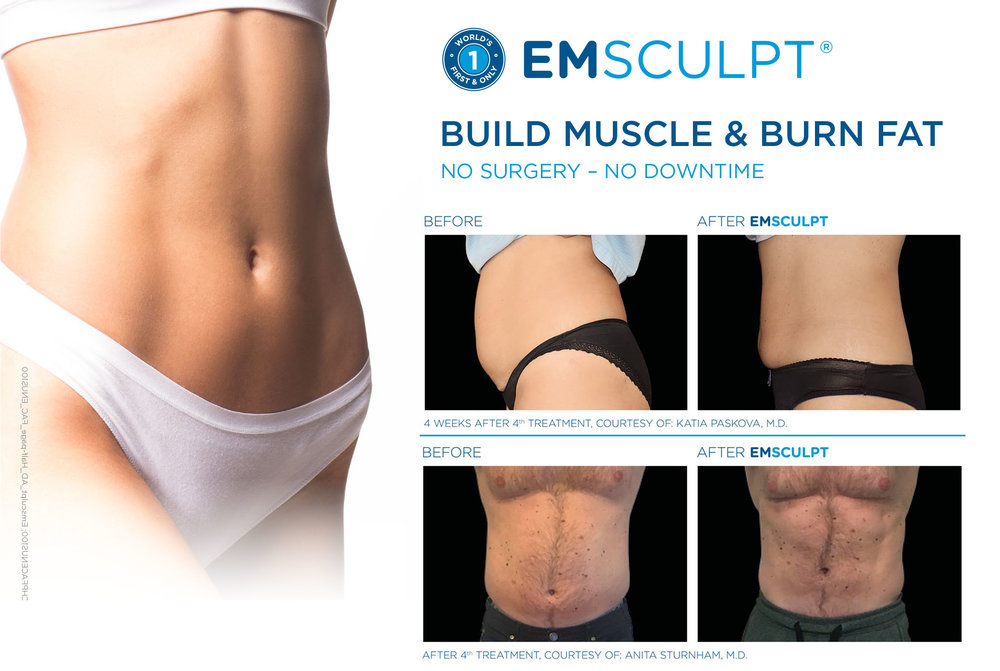 https://www.fountainmedicalspa.com/wp-content/uploads/2019/12/emsculpt-texas.jpg