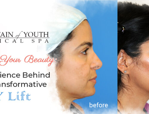 Achieve Youthful Elegance with the Y Lift at Fountain Medical Spa
