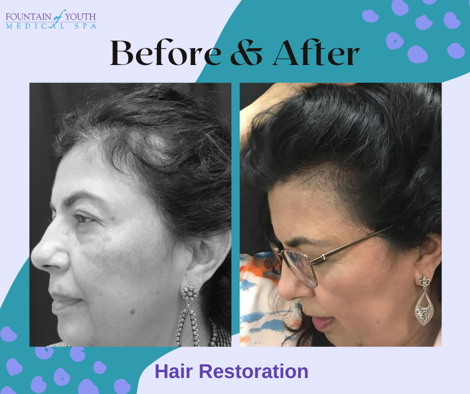 hair restoration in victoria texas