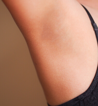 before-after-body-hair-removal-1-b