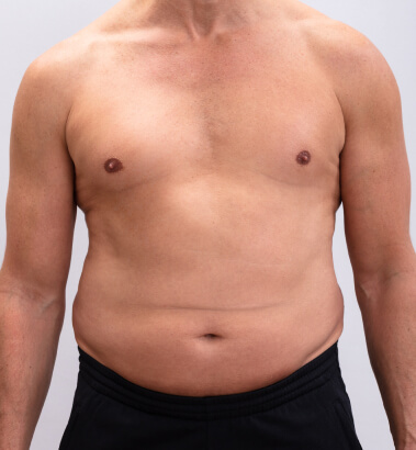 before-after-m8-burst-2-a