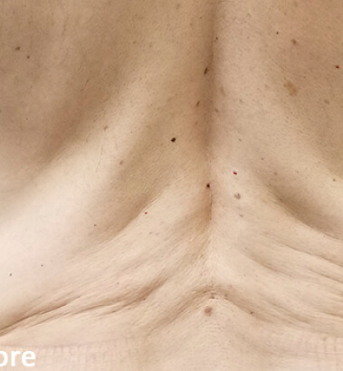 before-after-m8-burst-3-a-new-2