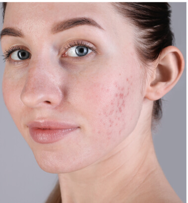 before-after-sofwave-2-a before-after-sofwave-2-a