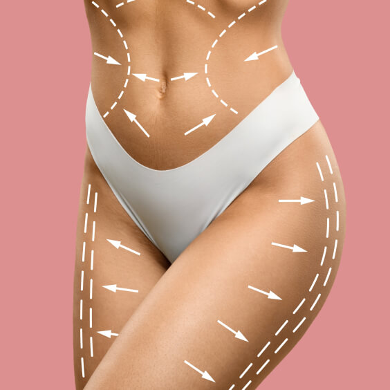Body Contouring