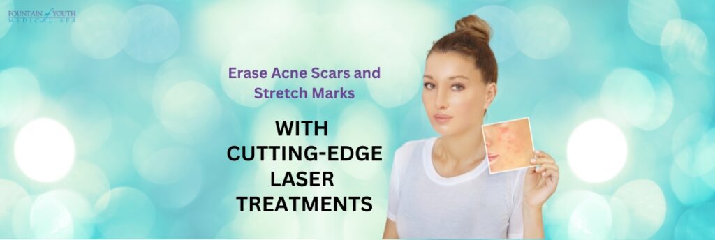 The Best Laser Treatments for Acne Scars and Stretch Marks in Victoria, TX