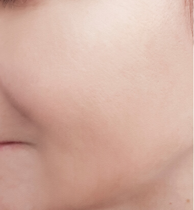 before-after-PRX-3-b