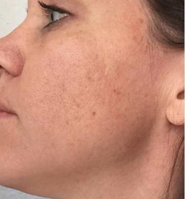 before-after-aqua-1-b