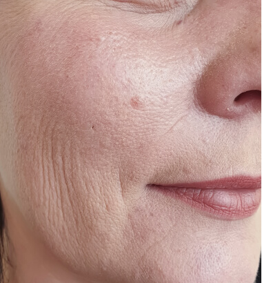 before-after-aqua-3-a