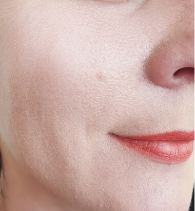 before-after-aqua-3-b