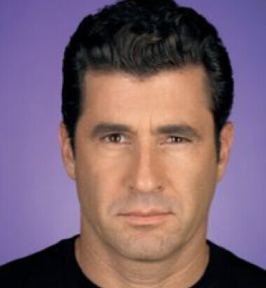 After Image: Botox - front
