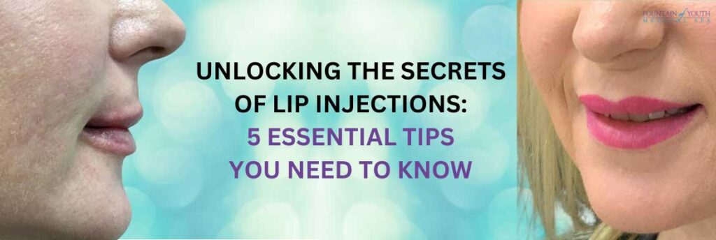 5 Essential Tips You Need to Know about Lip Injections