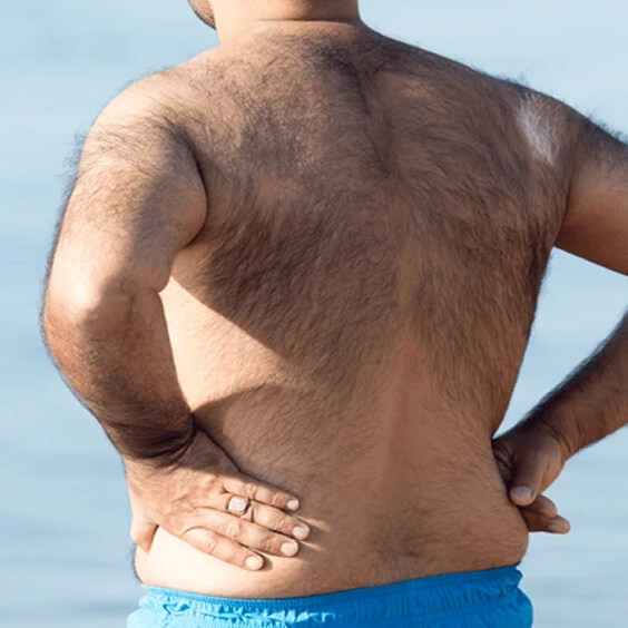 Unwanted Hair
